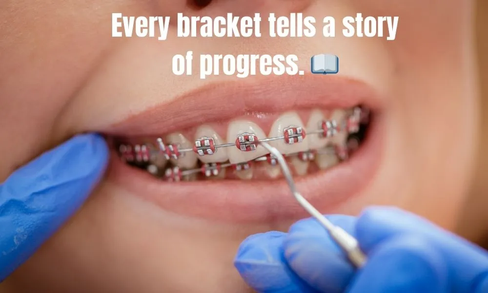Braces Captions for Instagram 