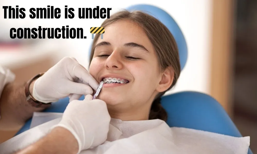 Funny Braces Captions for Instagram 